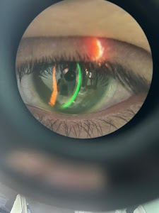 Lentes Esclerales | Contactología | Keralens place picture