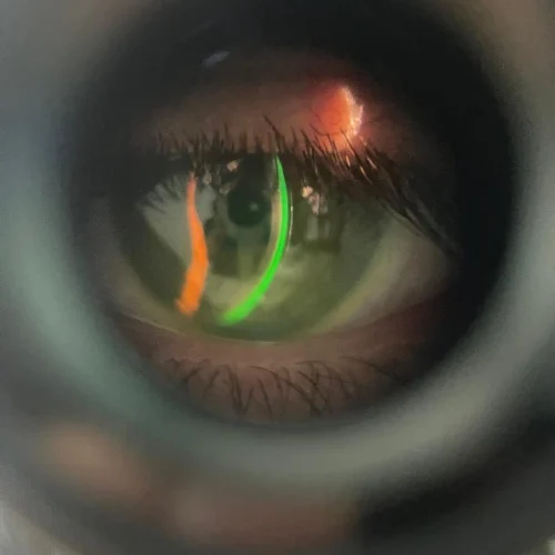3 (2)